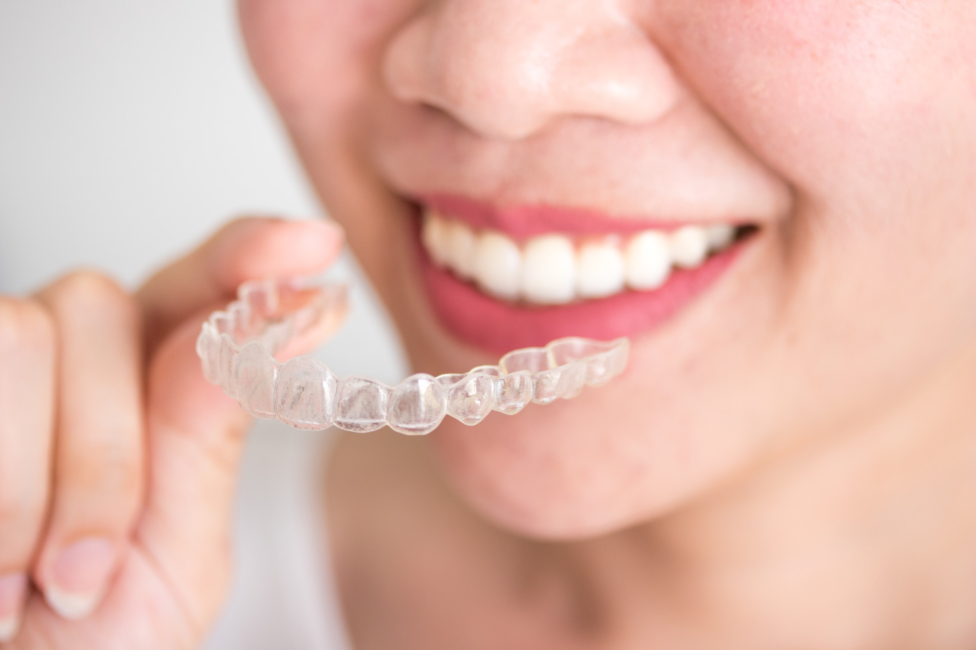 How To Determine Invisalign Cost